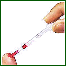 How to use HIV Home Kit rapid HIV instant test kits 6:  Use the supplied micro-pipette to gently suck the blood from your finger