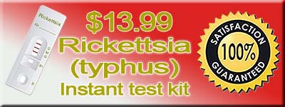 Buy HIV Home Kit rapid Rickettsia instant test kits, rapid typhus test kits for rapid rikettsia test results